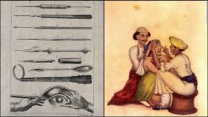 Ancient Eye Surgery